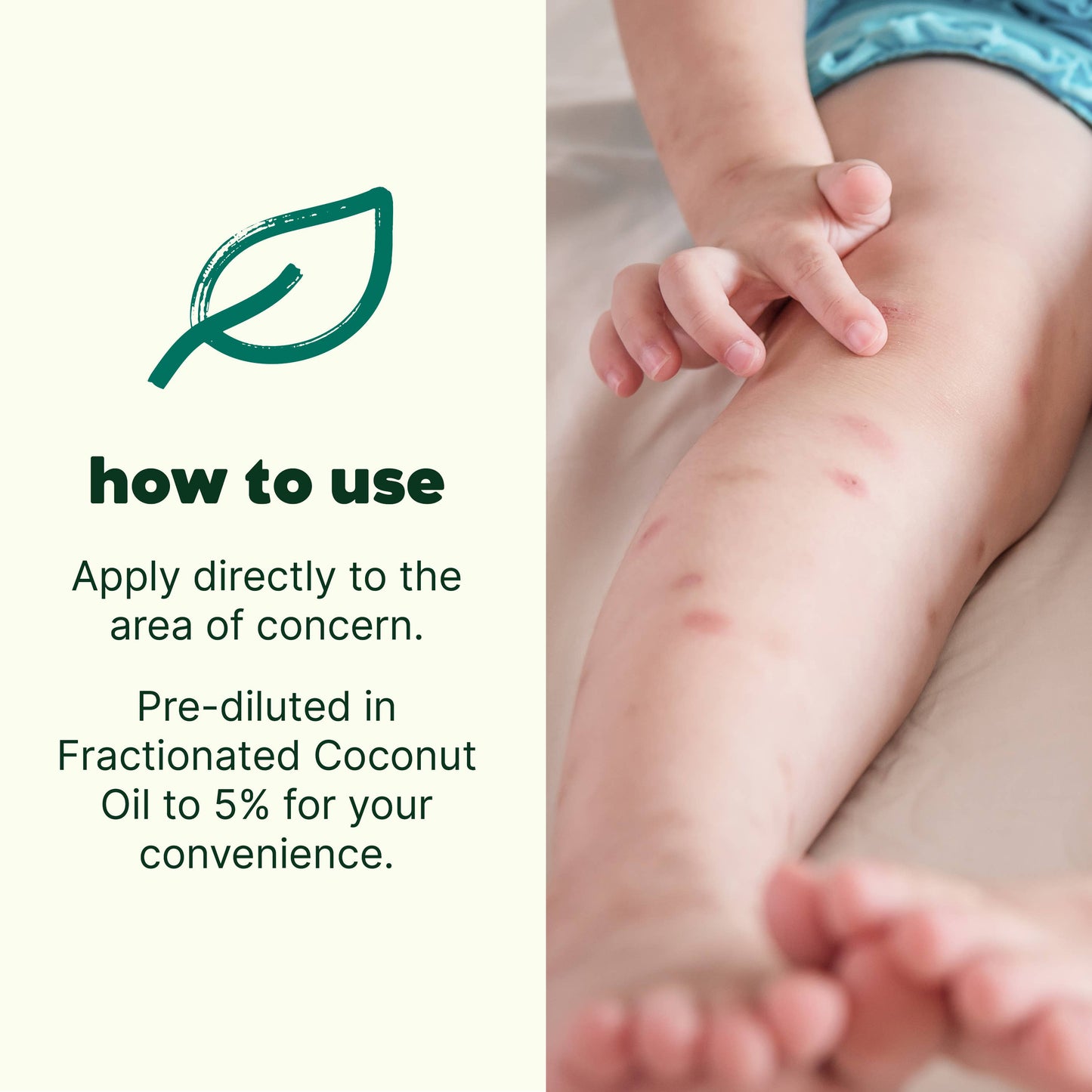 Itch Away KidSafe Essential Oil Pre-Diluted Roll On 10mL